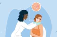 How to become a dermatologist